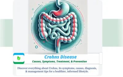 Crohns Disease : Causes, Symptoms, Treatment, & Prevention Illustration of Crohn's Disease showing inflamed intestines, stylized
