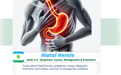 Hiatal Hernia : Causes, Symptoms, Prevention, & Treatment Illustration of acid reflux with focus on hiatal hernia anatomy and symptoms
