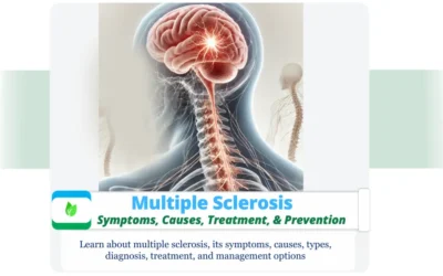 Multiple Sclerosis : Symptoms & Causes, Treatment, & Prevention Illustration of multiple sclerosis showing brain and spinal cord with neural pathway inflammation